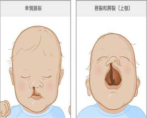东莞单身女性三代试管攻略，染色体平衡易位避坑指南